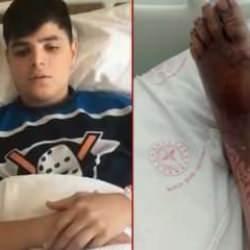 14 yaşındaki Turan, asit çamuruna bastı! Korkunç iddia...