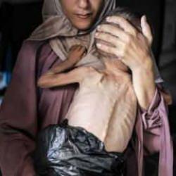 Son dakika: Gazze'den korkunç haber geldi! Durum felaket bir hal aldı...