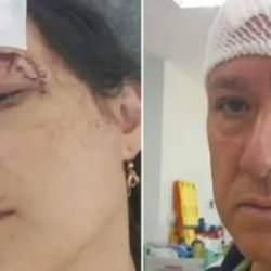 Tatilde kabusu yaşadılar! Demir sopalarla dövülüp hastanelik oldular