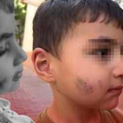 Uyurken dehşeti yaşadı: Lağım faresi ısıran çocuğa kuduz aşısı yapıldı!