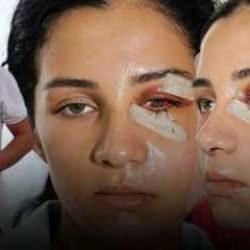 Eski kocası tarafından darbedilen Ganime, yaşadığı dehşeti anlattı