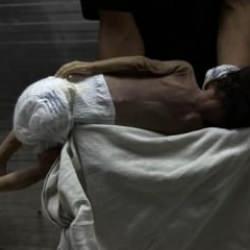 Gazze'de açlıktan 13 ölüm daha! İnsanlık sınav veriyor!