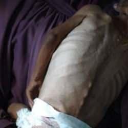 Gazze'de son 1 günde 1'i çocuk 6 kişi daha açlıktan şehit oldu