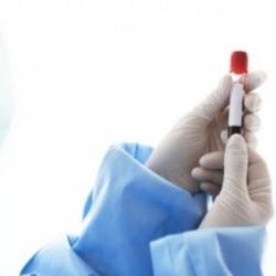 Sepsis her yıl 11 milyon insanı öldürüyor: İşte belirtiler ve korunma yolları