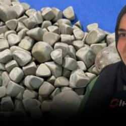 Doktorları şoke eden vaka! Vücudundan 287 tane taş çıkarıldı