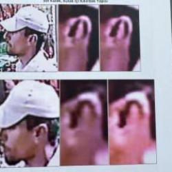 Kulağı 8 yıl sonra gerçeği ortaya çıkardı! 17 milyon lira tazminat başvurusu