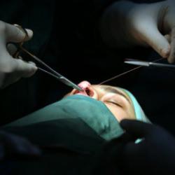 Merdiven altı estetik ve dövme İşlemlerine karşı uzman uyarısı