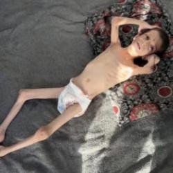 10 yaşındaki Gazzeli Nafız 4 aylık bebeğe dönüştü: Annesi taşımaya bile korkuyor