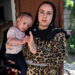 Hasta çocuğun fotoğrafıyla vurgun yaptılar! Yetmedi aileyle dalga geçtiler...