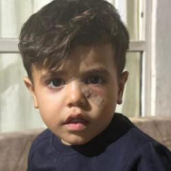 Şanlıurfa'da 4 yaşındaki çocuk oyun oynarken dehşeti yaşadı!