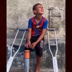 Bir lokma sevin&ccedil;, bir &ouml;m&uuml;rl&uuml;k acı: Gazze&rsquo;de bir &ccedil;ocuk, kendi protezini yaptı