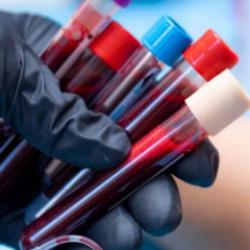 En zeki insanlar bu kan grubuna sahip! Zekanızı belirleyebilir mi?