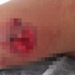 Yer: Bursa! Bir çocuk daha başıboş köpek tarafından parçalandı