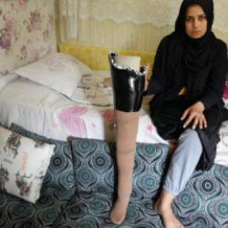 Depremde bacağını kaybeden kadın kocası tarafından terk edildiğini iddia etti