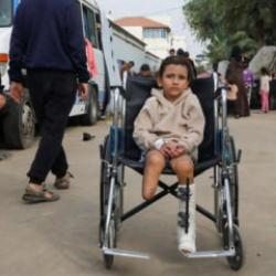 Kahreden oran! Gazze artık resmen 'ampute &ccedil;ocuklar diyarı' oldu