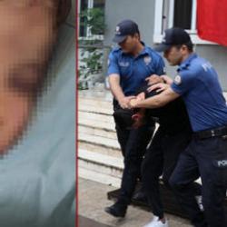 2 yaşındaki bebeği darbederek hastanelik etmişlerdi! Anne hakkında gelişme 