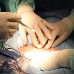 Anneler canlı organ naklinde ilk g&ouml;n&uuml;ll&uuml; don&ouml;r oluyor