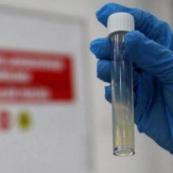 DSÖ açıkladı... Dünyanın en ölümcül bulaşıcı hastalığı oldu! 2024'te 1,23 milyon can aldı