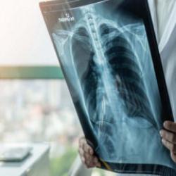 Prof. Dr. Şener 'süperenfeksiyon' için uyardı: ‘Dikkat etmek lazım, ücretsiz aşınızı olun