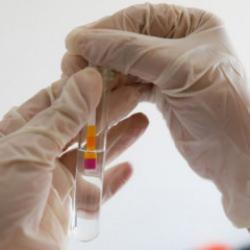 Beyin kanserine karşı geliştirilen yeni yöntem heyecan yarattı