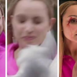 Muhabirin zor anları! Yüzüne kuş çarptı