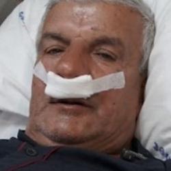 27 yıllık mesleğin şaşırtan sonucu: Burnundan 100 gramlık taş çıktı 