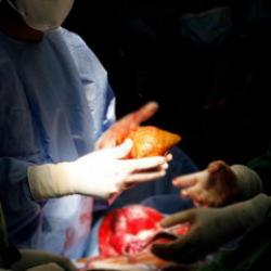 Kuduzlu böbrek nakli yapıldı, hayatını kaybetti