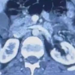 Üç İranlı röntgene girince yakayı ele verdi