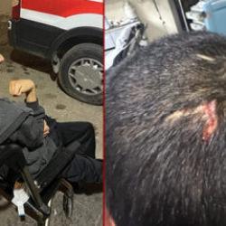 Gaziantep'te engelli bakım merkezinde darp iddiası!