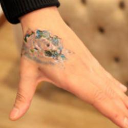 D&ouml;vme sildirmek istediği g&uuml;zellik merkezinden skandal &ouml;neri: Ağrın varsa ila&ccedil; al