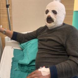 'Kalorifer kazanı' faciası: Y&uuml;z&uuml; tamamen yandı!