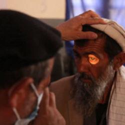 İHH 2025&rsquo;te 16 &uuml;lkede 17 bin 370 katarakt ameliyatı yaptı