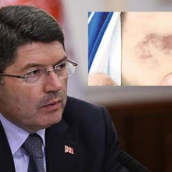 İBB kreşinde &ccedil;ocuğa darp ve istismar! Bakanlardan peş peşe a&ccedil;ıklama: 'İhbarlar ciddi'