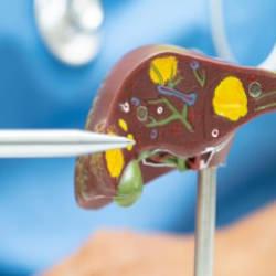 Bu kansere dikkat: Tedavi edilmezse yaşam oranı %15'lere d&uuml;ş&uuml;yor!