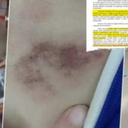 İBB&rsquo;den medyaya baskı babaya itham! Kreşteki rezaleti mağdur aileye yıktılar