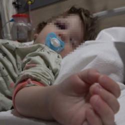 Korkun&ccedil; olay! 14 aylık bebeğin kafatası &ccedil;atladı! Bakan G&uuml;rlek'ten son dakika a&ccedil;ıklaması