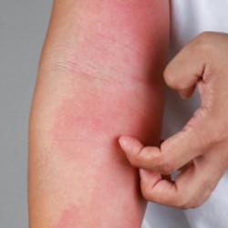 İstanbul'da kuduz iddiası! Valilikten a&ccedil;ıklama geldi