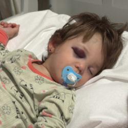 14 aylık bebeğin kafatası &ccedil;atlamıştı: T&uuml;rkiye'nin ayağa kalktığı olayda alt komşu konuştu