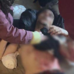 Beyoğlu&rsquo;nda &uuml;niversitede "d&ouml;nem &ouml;devi" dehşeti: G&ouml;ğs&uuml;nden 3 kez bı&ccedil;akladı! 