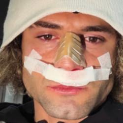 2. Lig'in gol kralının burnu kırıldı! Ma&ccedil;ı bu şekilde tamamladı