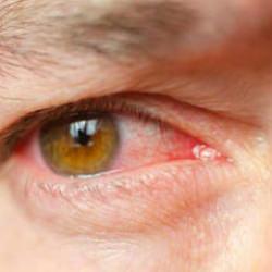 T&uuml;rkiye&rsquo;de 2 milyon kişi risk altında! Sessiz ilerliyor, kalıcı k&ouml;rl&uuml;ğe neden olabiliyor