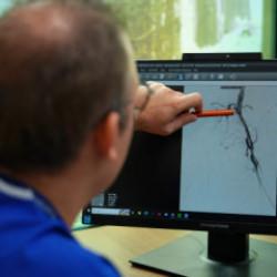 Uzman isim dikkat &ccedil;ekti: 2050'de 3 milyon kişi uzvunu kaybedebilir 