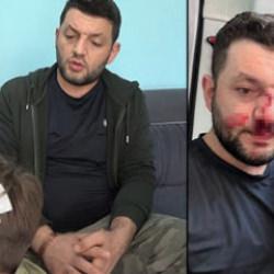 Yalova'da baba ile 14 aylık bebek darbedilmişti! Ailenin 8 yaşındaki &ccedil;ocuğu taşlandı