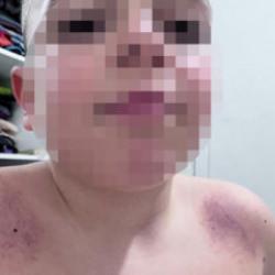 Antalya'da İlkokulda darp iddiası! Aile &ouml;ğretmenden şikayet&ccedil;i oldu