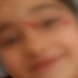 Yer: Ey&uuml;psultan! Okul d&ouml;n&uuml;ş&uuml; başıboş k&ouml;pek dehşeti: 6 yaşındaki &ccedil;ocuk hastanelik oldu