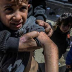 Gazze'de salgın uyarısı: Sağlık bakanlığından DS&Ouml;'ye &ccedil;ağrı