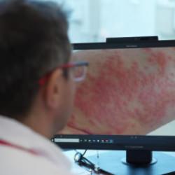 Uzmanından uyarı: Egzamalı &ccedil;ocuğa ezbere diyet yaptırmayın