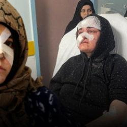 27 yaşındaki Nazlı dehşeti yaşadı! Kaldırım taşı 'silah' sayıldı