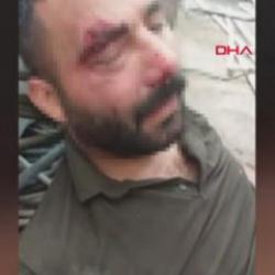 12 metre y&uuml;kseklikten beton zemine d&uuml;şen iş&ccedil;i: Ailemin tek ge&ccedil;im kaynağı benim