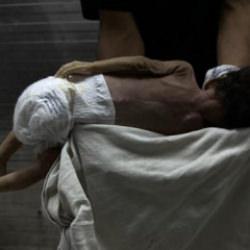 Gazze&rsquo;de sessiz felaket: Bebeklerde anomali ve &ouml;l&uuml;m oranları artıyor